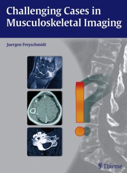 Challenging Cases in Musculoskeletal Imaging