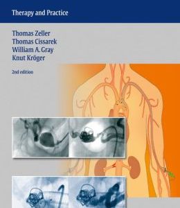Vascular Medicine: Therapy and Practice (ORIGINAL PDF from Publisher)