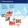 Microsurgical Management of Middle Ear and Petrous Bone Cholesteatoma (EPUB)