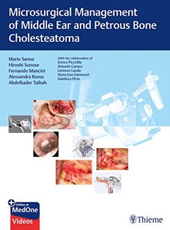 Microsurgical Management of Middle Ear and Petrous Bone Cholesteatoma (Original PDF from Publisher)