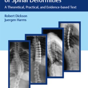 Modern Management of Spinal Deformities (EPUB)