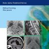 MR Neuroimaging: Brain, Spine, and Peripheral Nerves (EPUB)