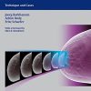 Digital Breast Tomosynthesis: Technique and Cases (ORIGINAL PDF from Publisher)
