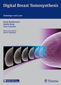 Digital Breast Tomosynthesis: Technique and Cases (ORIGINAL PDF from Publisher)