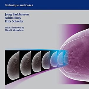 Digital Breast Tomosynthesis: Technique and Cases (ORIGINAL PDF from Publisher)