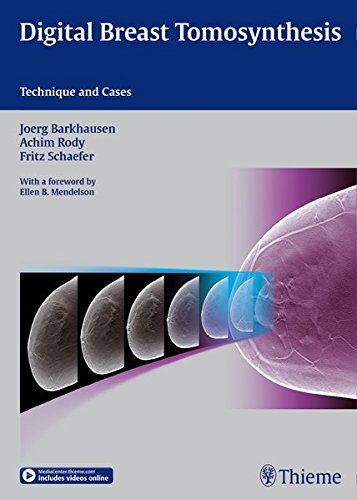 Digital Breast Tomosynthesis: Technique and Cases (ORIGINAL PDF from Publisher)