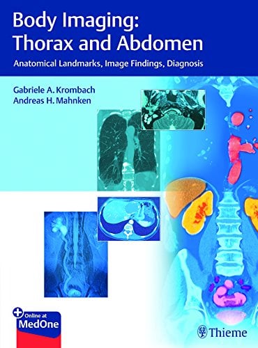 Body Imaging: Thorax and Abdomen: Anatomical Landmarks, Image Findings, Diagnosis (PDF)