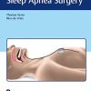 Current Concepts of Sleep Apnea Surgery (Original PDF from Publisher)