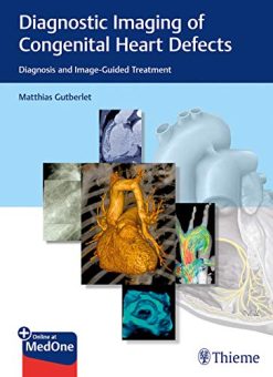 Diagnostic Imaging of Congenital Heart Defects: Diagnosis and Image-Guided Treatment (Original PDF from Publisher)