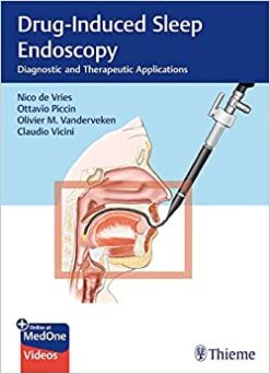 Drug-Induced Sleep Endoscopy: Diagnostic and Therapeutic Applications (EPUB)