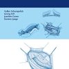 Hernia Surgery (PDF)