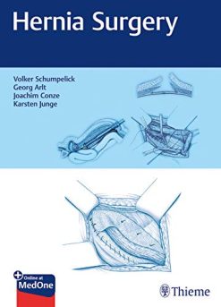 Hernia Surgery (PDF)