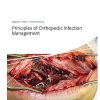 Principles of Orthopedic Infection Management (EPUB)