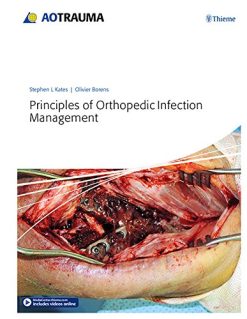 Principles of Orthopedic Infection Management (EPUB)