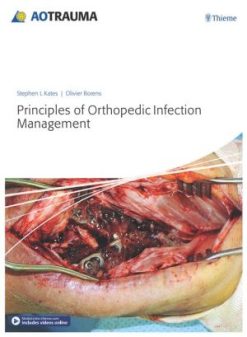 Principles of Orthopedic Infection Management (PDF)