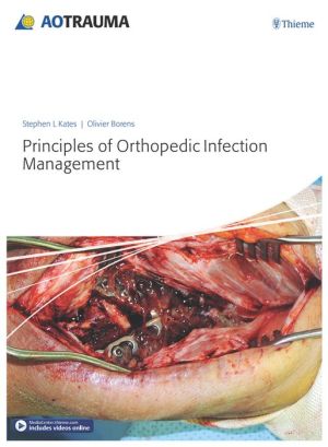 Principles of Orthopedic Infection Management (PDF)