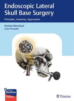 Endoscopic Lateral Skull Base Surgery: Principles, Anatomy, Approaches (Original PDF from Publisher+Videos)