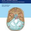 Meningiomas of the Skull Base: Treatment Nuances in Contemporary Neurosurgery (PDF)