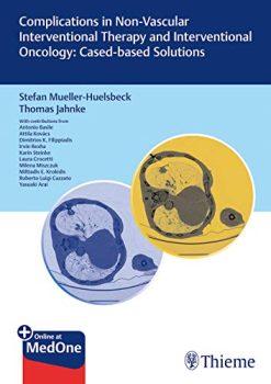Complications in Non-vascular Interventional Therapy and Interventional Oncology: Case-based Solutions (Original PDF from Publisher)