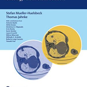 Complications in Non-vascular Interventional Therapy and Interventional Oncology: Case-based Solutions (Original PDF from Publisher)