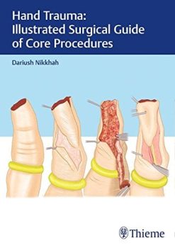 Hand Trauma: Illustrated Surgical Guide of Core Procedures (PDF)