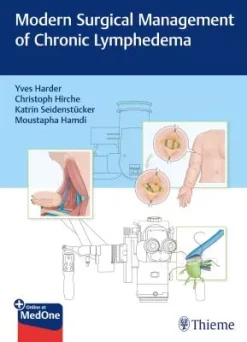 Modern Surgical Management of Chronic Lymphedema (Original PDF from Publisher)