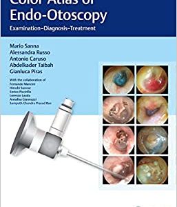 Color Atlas of Endo-Otoscopy: Examination-Diagnosis-Treatment, 1st edition (EPUB)