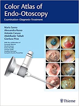 Color Atlas of Endo-Otoscopy: Examination-Diagnosis-Treatment, 1st edition (EPUB)