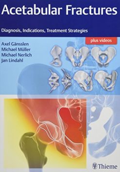 Acetabular Fractures: Diagnosis, Indications, Treatment Strategies (PDF)
