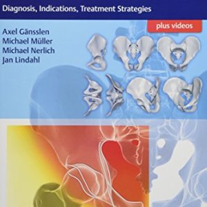 Acetabular Fractures: Diagnosis, Indications, Treatment Strategies (PDF)
