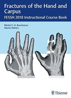 Fractures of the Hand and Carpus: FESSH 2018 Instructional Course Book (Original PDF from Publisher)