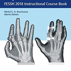 Fractures of the Hand and Carpus: FESSH 2018 Instructional Course Book (Original PDF from Publisher)