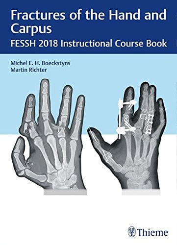 Fractures of the Hand and Carpus: FESSH 2018 Instructional Course Book (Original PDF from Publisher)