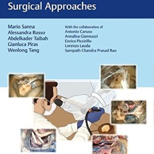 The Temporal Bone: Anatomical Dissection and Surgical Approaches (PDF)