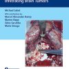 Video Atlas of Neurophysiological Monitoring in Surgery of Infiltrating Brain Tumors (Original PDF from Publisher+Videos)