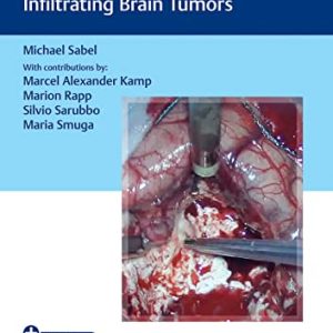Video Atlas of Neurophysiological Monitoring in Surgery of Infiltrating Brain Tumors (Original PDF from Publisher+Videos)