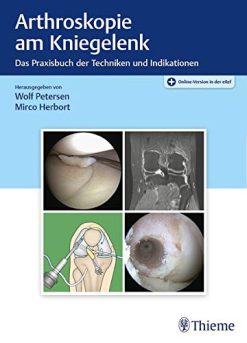 Arthroskopie am Kniegelenk (Original PDF from Publisher)