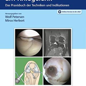 Arthroskopie am Kniegelenk (Original PDF from Publisher)