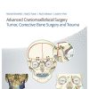 Advanced Craniomaxillofacial Surgery: Tumor, Corrective Bone Surgery, and Trauma (Original PDF from Publisher)