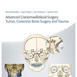 Advanced Craniomaxillofacial Surgery: Tumor, Corrective Bone Surgery, and Trauma (Original PDF from Publisher)