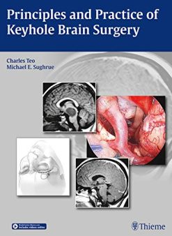 Principles and Practice of Keyhole Brain Surgery (Videos Only)