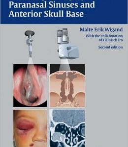 Endoscopic Surgery of the Paranasal Sinuses and Anterior Skull Base, 2nd Edition