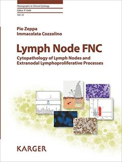 Lymph Node FNC: Cytopathology of Lymph Nodes and Extranodal Lymphoproliferative Processes (Monographs in Clinical Cytology, Vol. 23) (PDF)