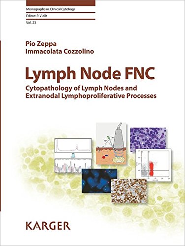 Lymph Node FNC: Cytopathology of Lymph Nodes and Extranodal Lymphoproliferative Processes (Monographs in Clinical Cytology, Vol. 23) (PDF)