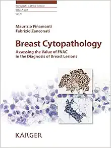 Breast Cytopathology: Assessing the Value of Fnac in the Diagnosis of Breast Lesions (Monographs in Clinical Cytology) (EPUB)
