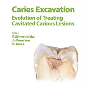 Caries Excavation: Evolution of Treating Cavitated Carious Lesions (Monographs in Oral Science, Vol. 27) (PDF)
