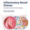 Fast Facts: Inflammatory Bowel Disease for Patients and their Supporters: Ulcerative colitis and Crohn’s disease Information + Taking Control = Best Outcome (Original PDF from Publisher)