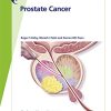 Fast Facts: Prostate Cancer: If, when and how to intervene (Original PDF from Publisher)