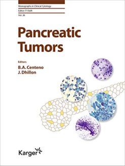 Pancreatic Tumors (Monographs in Clinical Cytology, Vol. 26) (Original PDF from Publisher)