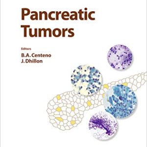 Pancreatic Tumors (Monographs in Clinical Cytology, Vol. 26) (Original PDF from Publisher)